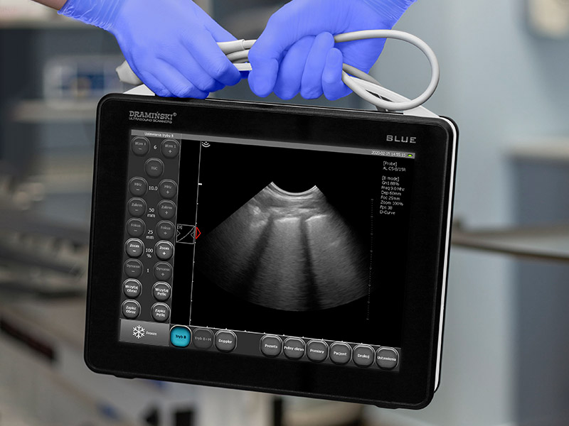 Dramiński Blue scanner ad ultrasuoni dedicato all'esame polmonare